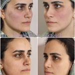 کلینیک زیبایی و لیزر مایا (دکتر وحیدی)