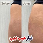 کلینیک پوست و زیبایی ژیلاوَش