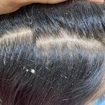 خدمات اسکراب اسکالپ ‌و کراتین ندا