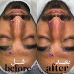 سالن تخصصی کوتاهی مو و فیشیال امیربارویی