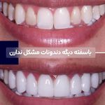 کنزودنت