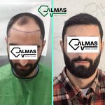 کلینیک پوست،زیبایی ولیزر وکاشت مو الماس
