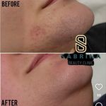 مطب لیزر و پوست و مو سابرینا شعبه نارمک