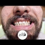 کلینیک دندان پزشکی و ایمپلنت الیسو