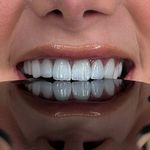 دندانسازی سبز  dental green lab