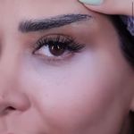 کلینیک زیبایی الماس کاملا اقساطی