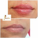 کلینیک پوست،مو،زیبایی و لیزر دالیا