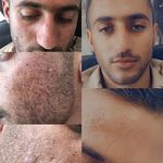 پیرایش پدرام