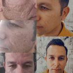 پیرایش پدرام