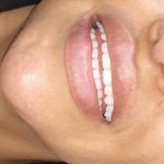 دندانسازی حسینی