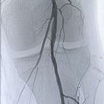 محمدرضا اخباری فوق تخصص قلب و عروق