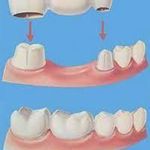 لابراتوار دندانسازی  (خبات مرادی)