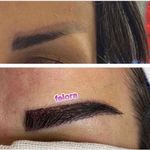 کاشت تخصصی ابرو فلورا