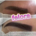 کاشت تخصصی ابرو فلورا