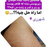 مرکز تخصصی لیزر موهای زائد بخشی