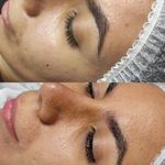 پاکسازی وفیشال اتاق پوست آزیتا