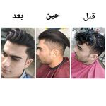 پیرایش ایستگاه مو