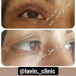 کلینیک پوست، مو و زیبایی لاوین