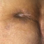 مرکز خدمات پرستاری درمانی یاسین زخم بستر