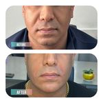 مرکز لیزر و زیبایی هوراماه