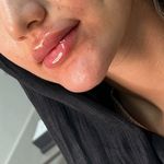 مرکز لیزر و زیبایی هوراماه