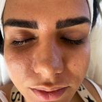 کلینیک پوست مو زیبایی و مرکز لیزر تندیس