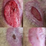 مرکز خدمات پرستاری درمانی یاسین زخم بستر