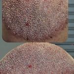 کلینیک کاشت مو و ابرو آذرنوش