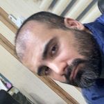 کلینیک کاشت مو و ابرو آذرنوش