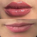 کلینیک پوست مو لیزر و لاغری عصر زیبایی