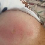 مرکز لیزر و زیبایی دکتر یعقوب اصفهانی