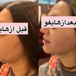 کلینیک زیبایی ،لیزر و لاغری گل مریم