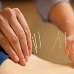 مرکز تخصصی طب سنتی و سوزنی رویال تبریز