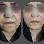 کلینیک زیبایی، لیزر، لاغری دُریتا