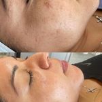 فشیال تخصصی درمانی پوست