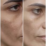 کلینیک پوست مو و لیزر و زیبایی بهرویان