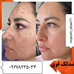 لوازم آرایشی و بهداشتی ندا انلاین شاپ