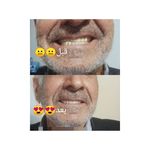 دندانسازی پیشداد