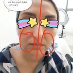 کلینیک لاغری، هایفو تراپی دکتر پوران