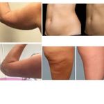 بهترین کلینیک زیبایی فلاح هایفو سودا