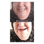 دندانسازی پیشداد