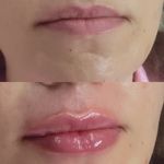 کلینیک پوست مو و لیزر و زیبایی بهرویان