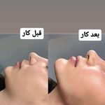 کلینیک زیبایی نومیا