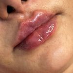 مرکز لیزر و کلینیک پوست مو زیبایی سپید