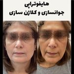 کلینیک پوست مو لیزر و لاغری عصر زیبایی