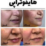 کلینیک پوست مو لیزر و لاغری عصر زیبایی