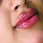 مرکزکلینیک لیزر زیبایی پوست و مو آسا