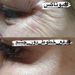 مرکز لیزر الماس میرداماد