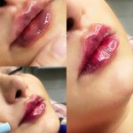 مرکز لیزر و کلینیک پوست مو زیبایی سپید