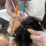 کلینیک تخصصی پوست و مو لیزر‌موهای زائد الیزا